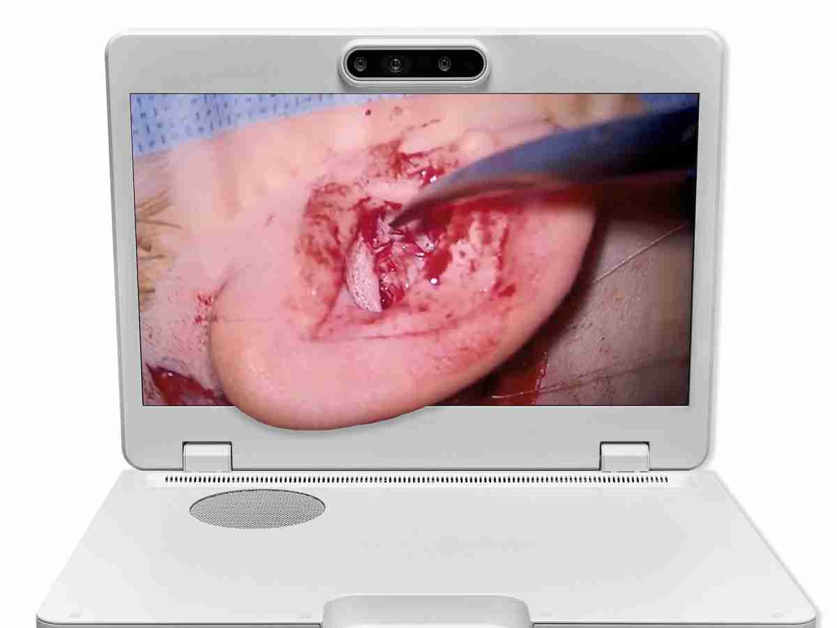 达擎之＂Heads-up 3D显微手术显示系统＂，，整合4K裸眼3D显示及眼球追踪系统，，，，具备快速追踪人眼移动位置功能，，减轻医师长时间维持固定姿势的负担，，，，让医师能有更宽广清晰的3D立体视野及更舒适的姿势来执行手术。。